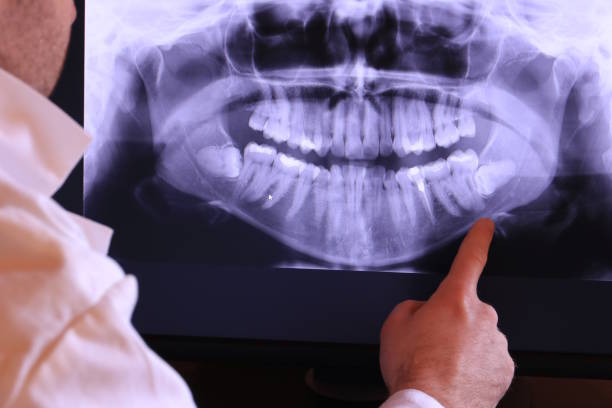 Best Emergency TMJ Treatment in Thomaston, GA