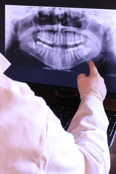 Best Emergency Dental Care for Broken or Chipped Teeth in Thomaston, GA